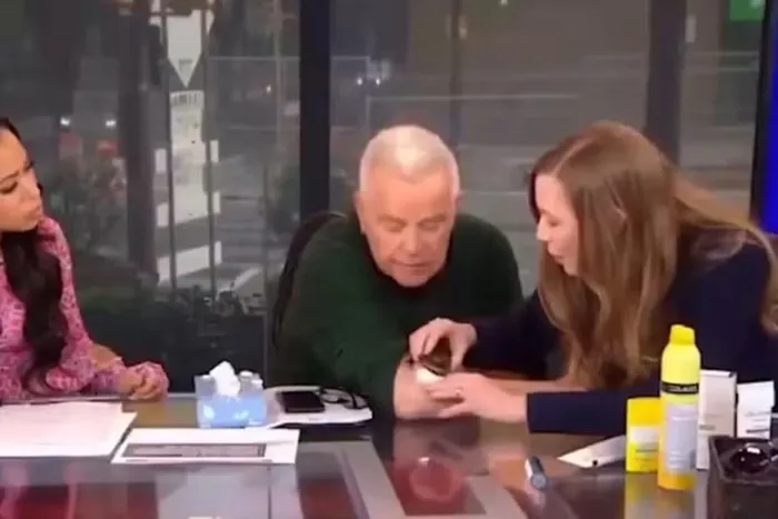 Apresentador descobre câncer de pele ao vivo na TV