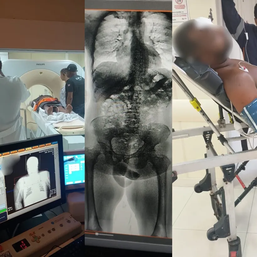 BodyScan identifica drogas ingeridas por internos durante retorno de saída temporária em Lauro de Freitas